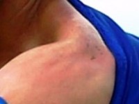 Suarez kafshon Chiellinin2