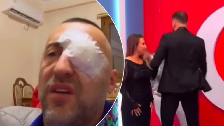 Reagon G-Bani pas incidentit në BBVA: O yll, o dritë sa do të durosh më shumë, gabim kam bërë që të kam shtyrë